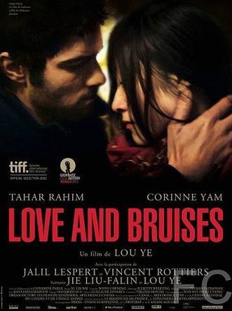    / Love and Bruises 